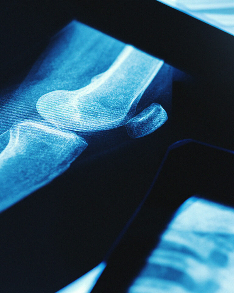 ForCast Orthopedics